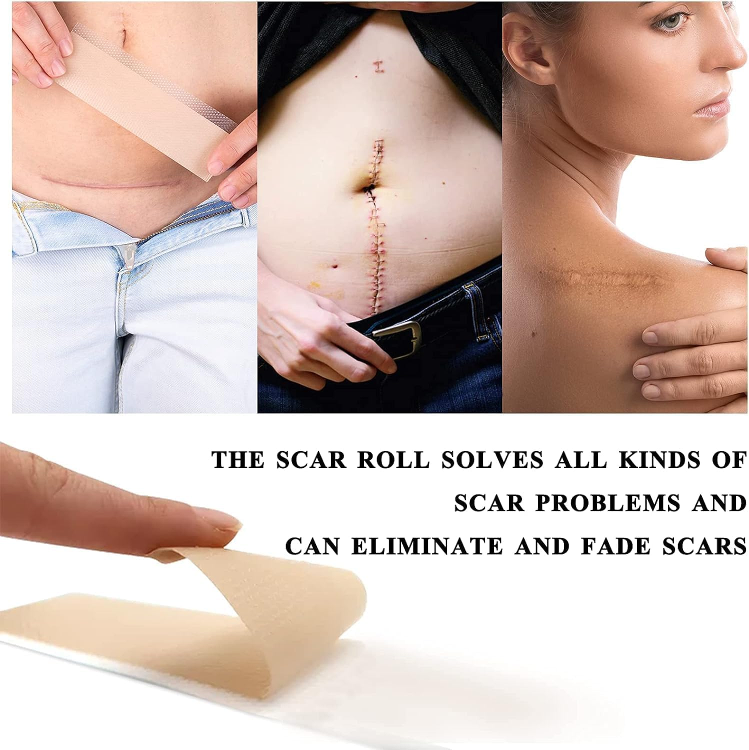 Silicone Scar Sheets,Scar Removal Silicone Tape Roll for C-Section,Professional Painless Silicone Keloid Scars from Surgery, Burn, Acne Et (1.6&rdquo; X 60&rdquo;Roll-1.5M) image number 5