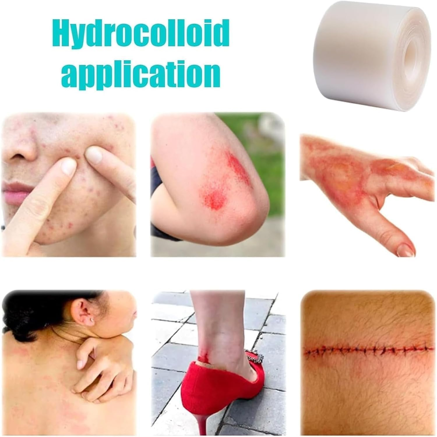 Hydrocolloid Bandages Roll - Cut-To-Size, Medical Grade Hydrocolloid Roll, Hydrocolloids Rolls Tape, Ultra Absorbent, Flexible & Waterproof (5Cm*2M)