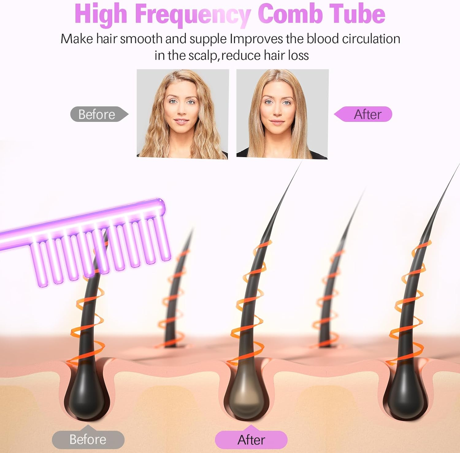 High Frequency Stick Face Portable Hand Electrode Stick Glass Tube Skin Therapy Device with 4 Argon Rods - Acne Treatment - Skin Tightening - Wrinkle Reduction image number 1