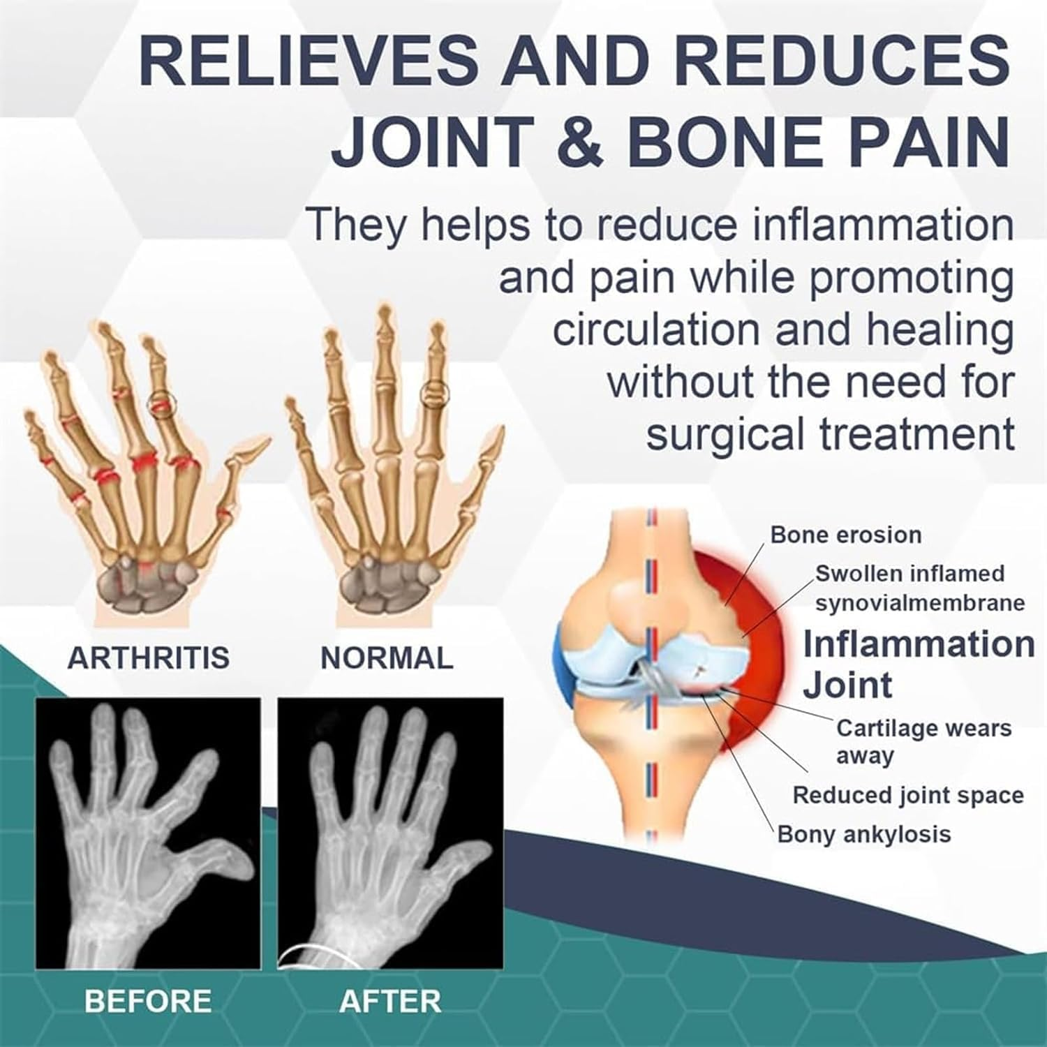 3Pcs Bee Venom Pain and Bone Healing Cream,Advanced Bee Venom Gel Joint and Bone Therapy,New Zealand Bee Venom Joint and Bone Therapy Cream image number 5