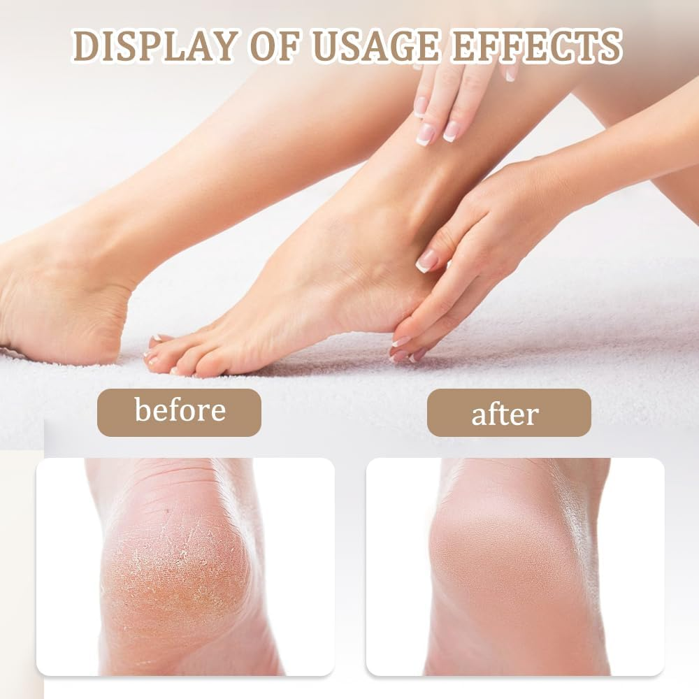 XFSRG 2-In-1 Nano Glass Callus Remover, Highly Effective Callus File, Pedicure for Feet, Callus Removal, Foot Care Device (Black) image number 4