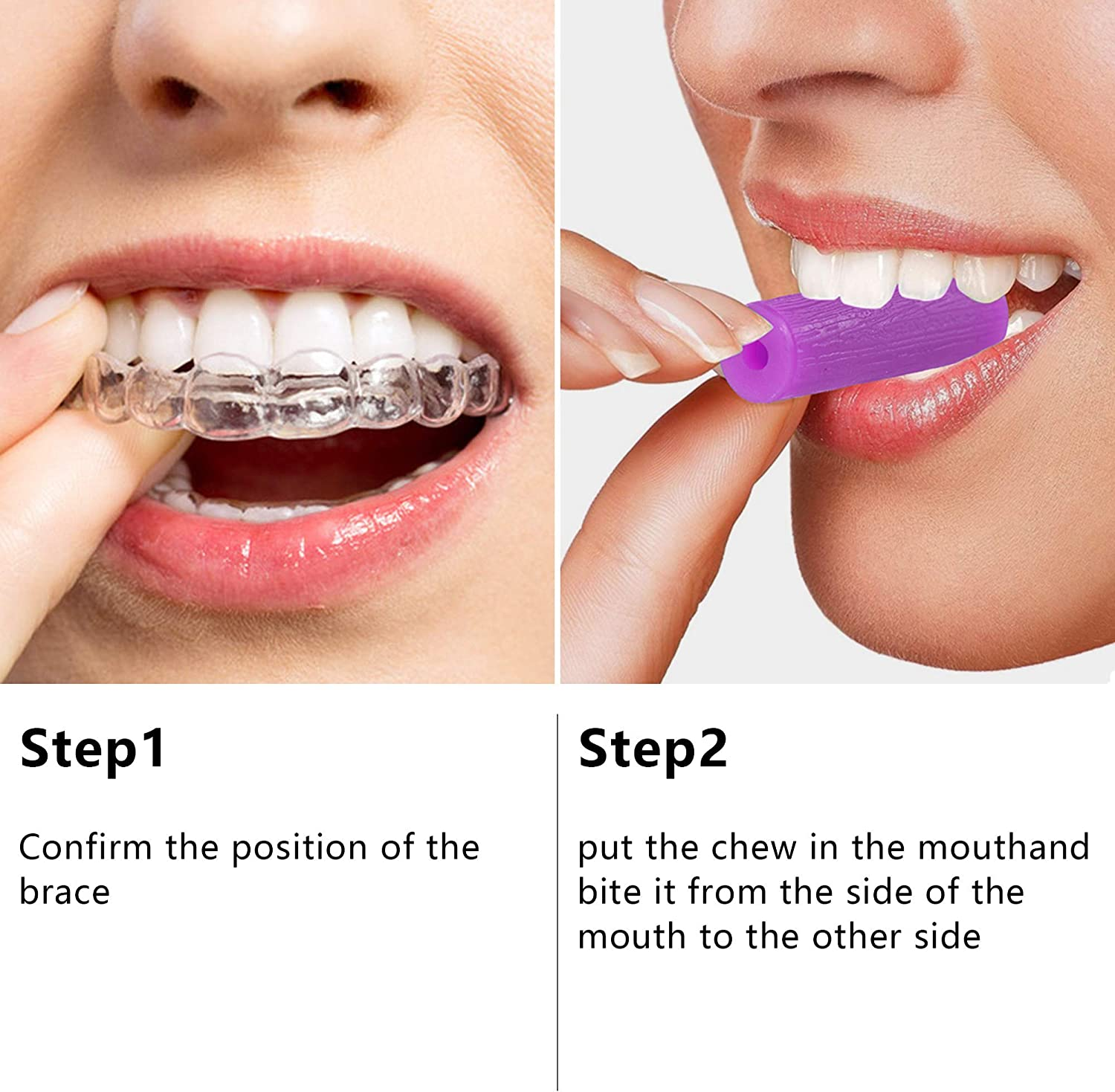 20 Pcs Aligner Tray Seaters Aligner Chewies Aligner Seater Chewies for Aligner Trays Chompers Aligner Trays 5 Colors