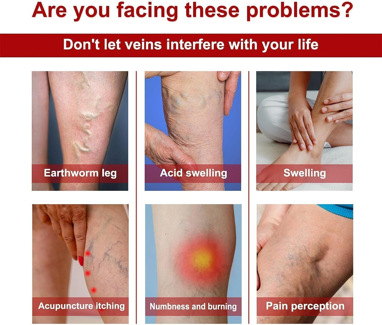 3 Pcs Medilisk Cream Varicose Veins,Medilisk Varicose Veins Relief Cream,Varicose Veins Treatment for Legs,Remove Varicose Veins, Improves Blood Circulation