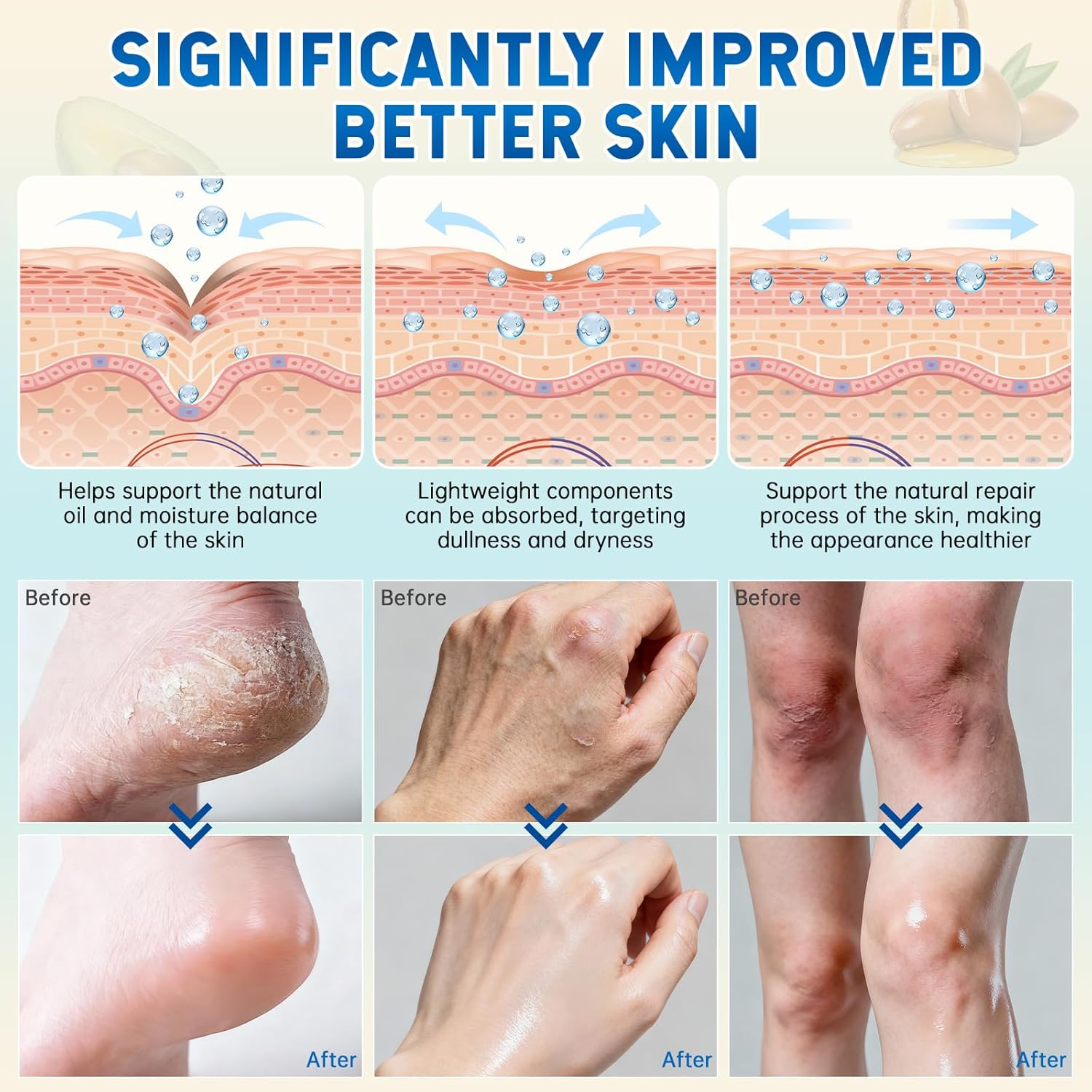 60% Urea Cream with 2% Salicylic Acid & Aloe Vera - Intensive Moisturizing Urea Foot Cream for Dry, Cracked Feet - Exfoliates Dead Skin, Smooths Rough Areas - Hydrating Foot Cream Stick for All Skin Types image number 7