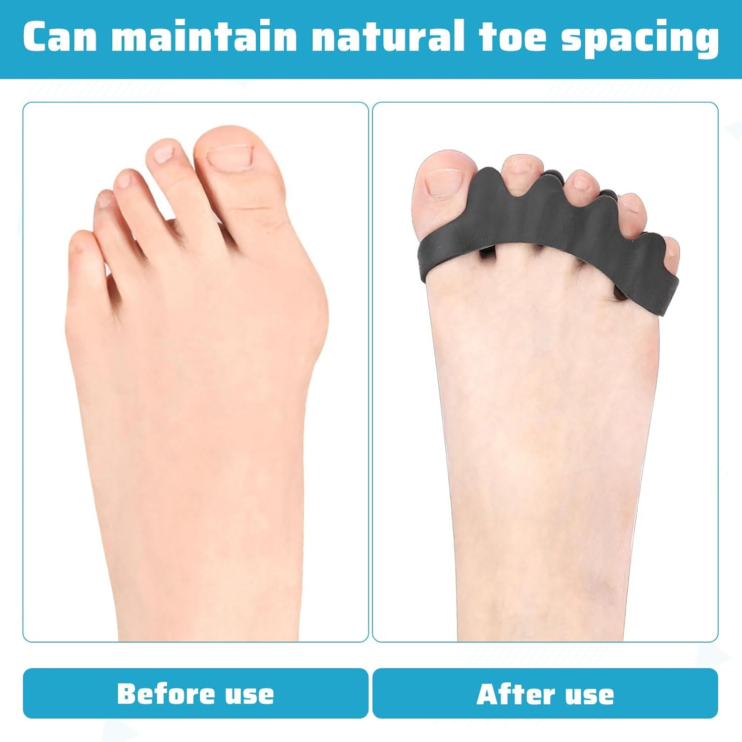 2 Pairs Toe Separators, Toe Spacers, Bunion Corrector for Women, Medical Grade Silicone Toe Spacer, Toe Spreaders, Toe Straightener, Big Toe Stretcher for Pain Relief and Their Original Shape image number 3
