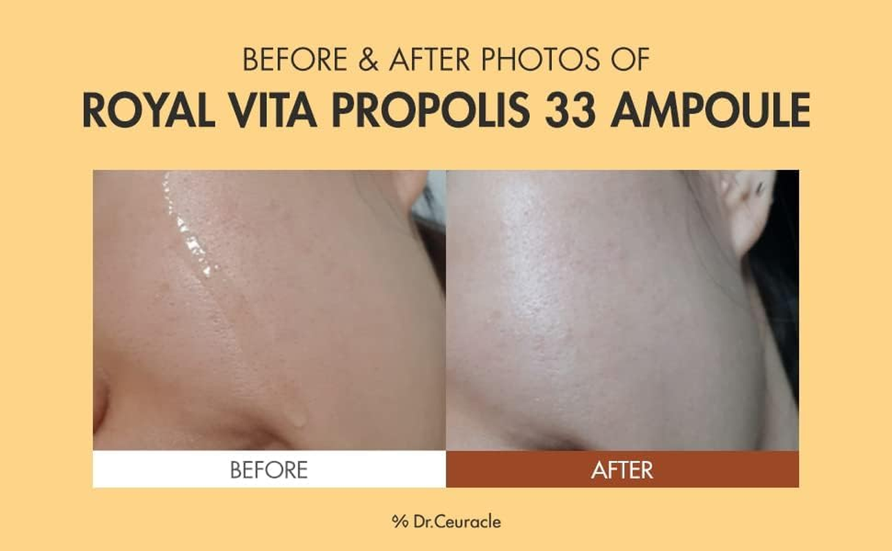 Honey Nourishing EssenceㅣRoyal Vita Propolis 33 AmpouleㅣKorean Skin Care Contains Royal Jelly Extract, PanthenolㅣEffective Vitamin Serum Strengthen the Skin Moisturizing, SoothingㅣDr.Ceuracle image number 2