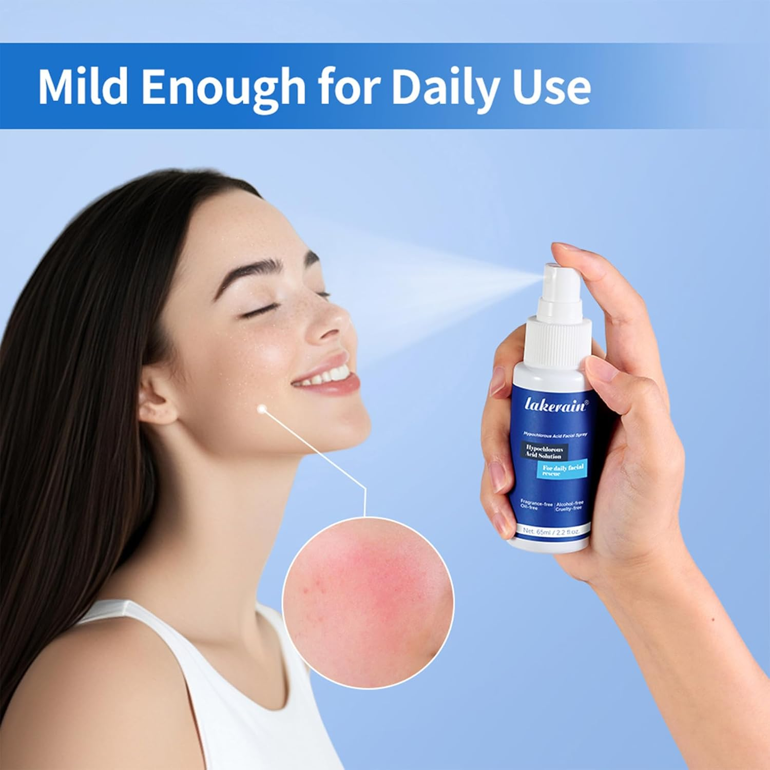 Hypochlorous Acid Face and Skin Spray,65Ml Soothing Facial Spray Face Toner, Hypochlorous Acid Spray for Red and Swollen Skin, Broken Skin Calming Emulsion for Sensitive Skin image number 2