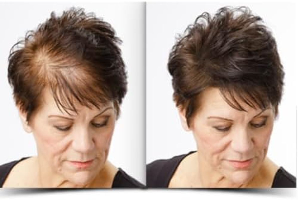 Osking Hair Building Fiber, Concealer Refill Use for Regrowth & All Other Hair Fiber Etc. (Black 25+25+25G) Pack of 3 image number 1