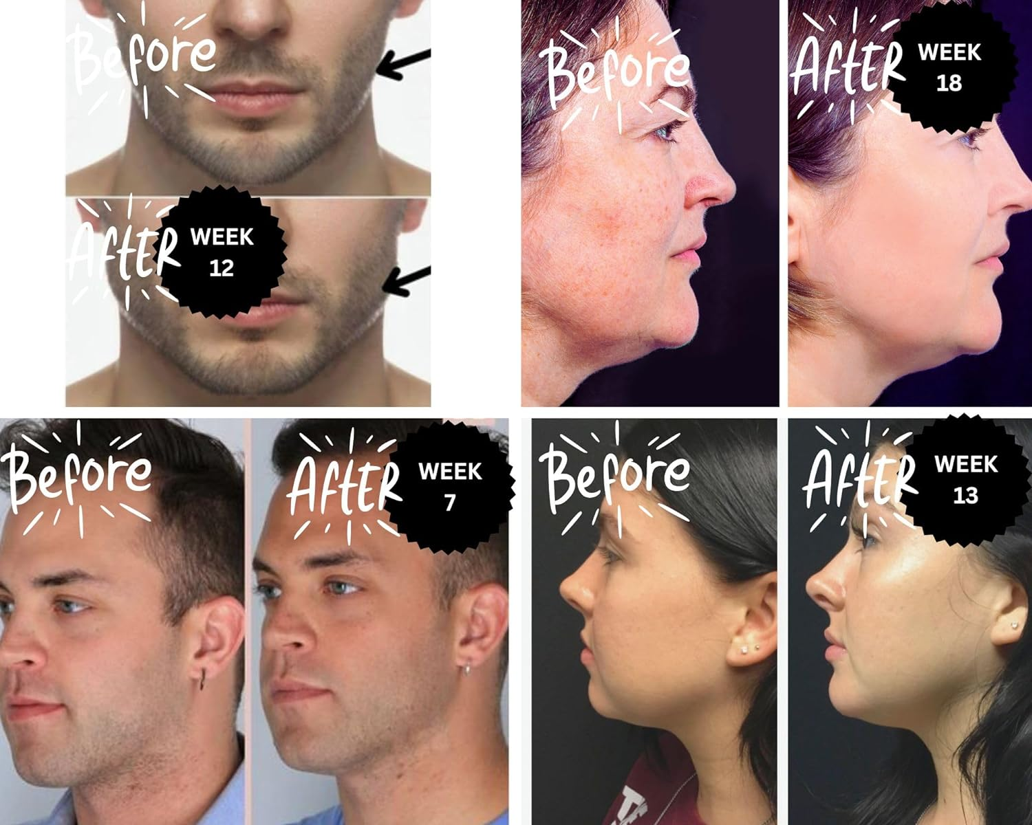 Gumbells&trade; 12Xhard Jawline & Facial Fitness Xylitol Chewing Gum (2MONTH-PACK) Enhance, Define & Strengthen Your Jaw Jawline Face Mouth & Jawrz Chios Style Workout Exerciser Trainer GUM 4 Men & Women image number 1