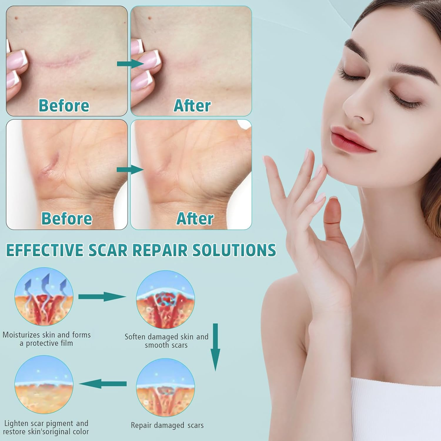 Advanced Scar Cream, Silicone Gel for Scars, Professional Scar Removal Cream for Surgical Scars, Stretch Marks, Old and New Scars 1.7 Oz(50Ml) image number 4