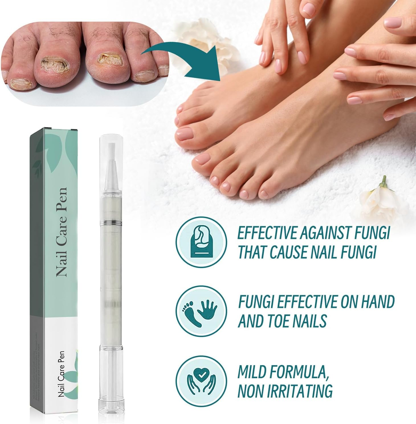 Nail Care Pen, Nail Care Pen Nail Fungus Pen Steiger Naturals Nail Care Pen Nail Fungus Pen Austria (Pack of 5) image number 3