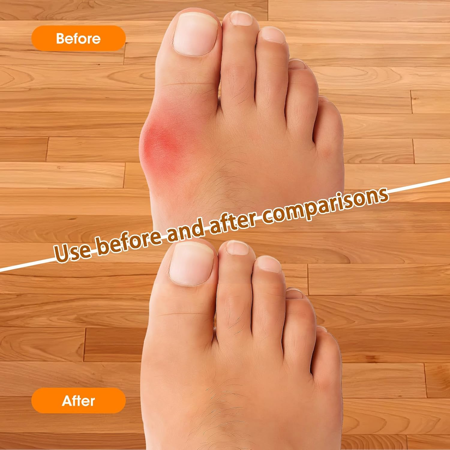 2 Pairs Silicone Toe Separators, Feet Gel Spacers to Correct Bunions and Restore Toes, Yoga Training Therapeutic Relief Pain Hammer & Claw Toe Flamingo Feet Corrector for Women & Men (Skin-Color)