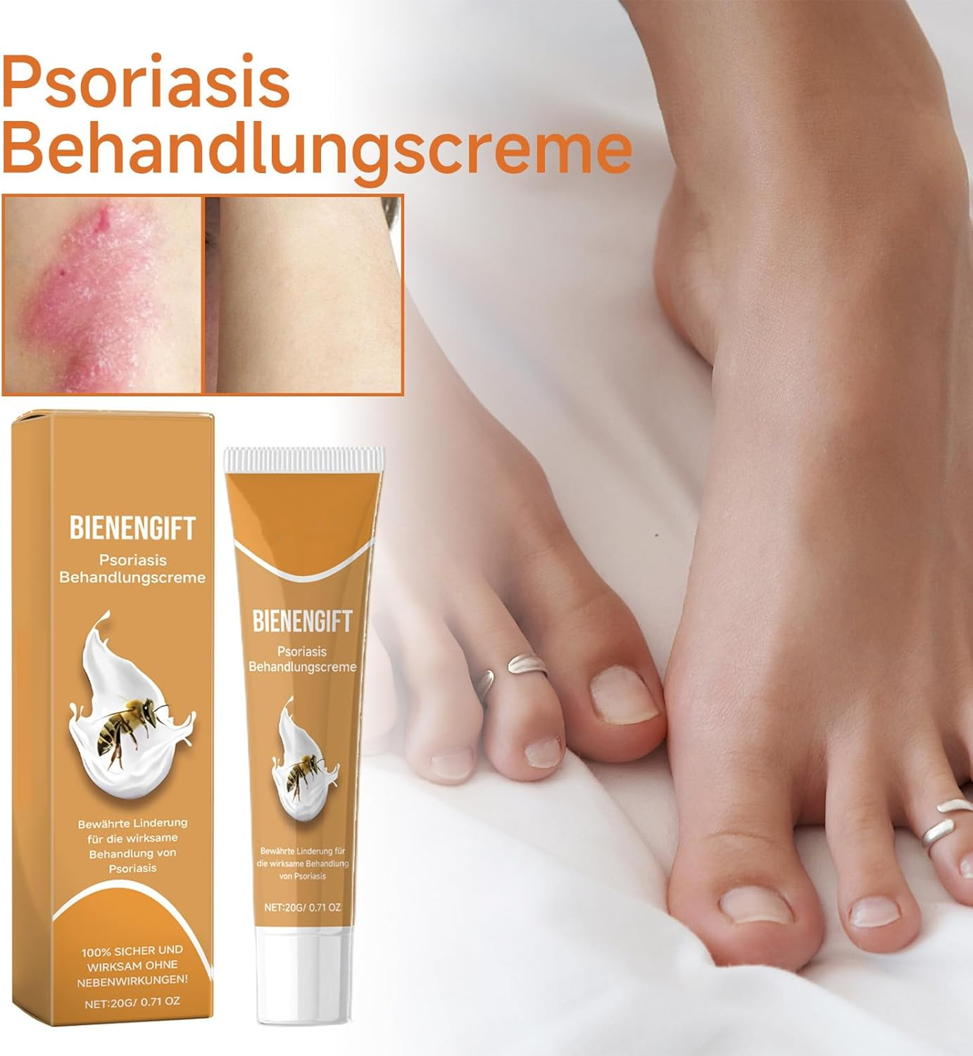 20G Skin Care Cream, Can Relieve Redness, Itching, Relieve and Moisturize Skin Care