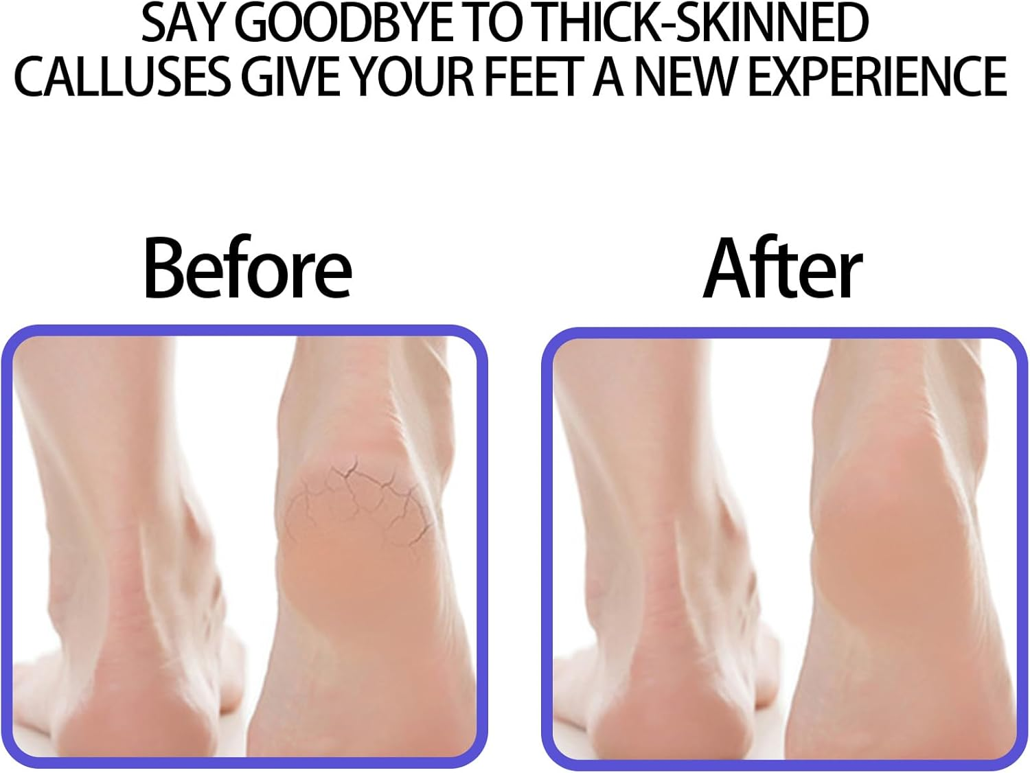 6 Pcs Foot Scrubber, Natural Foot Pumice, Deep-Clean Foot Exfoliator, Suitable Pumice Stone for Feet, Heel Callus, Foot Care Home Spa image number 6