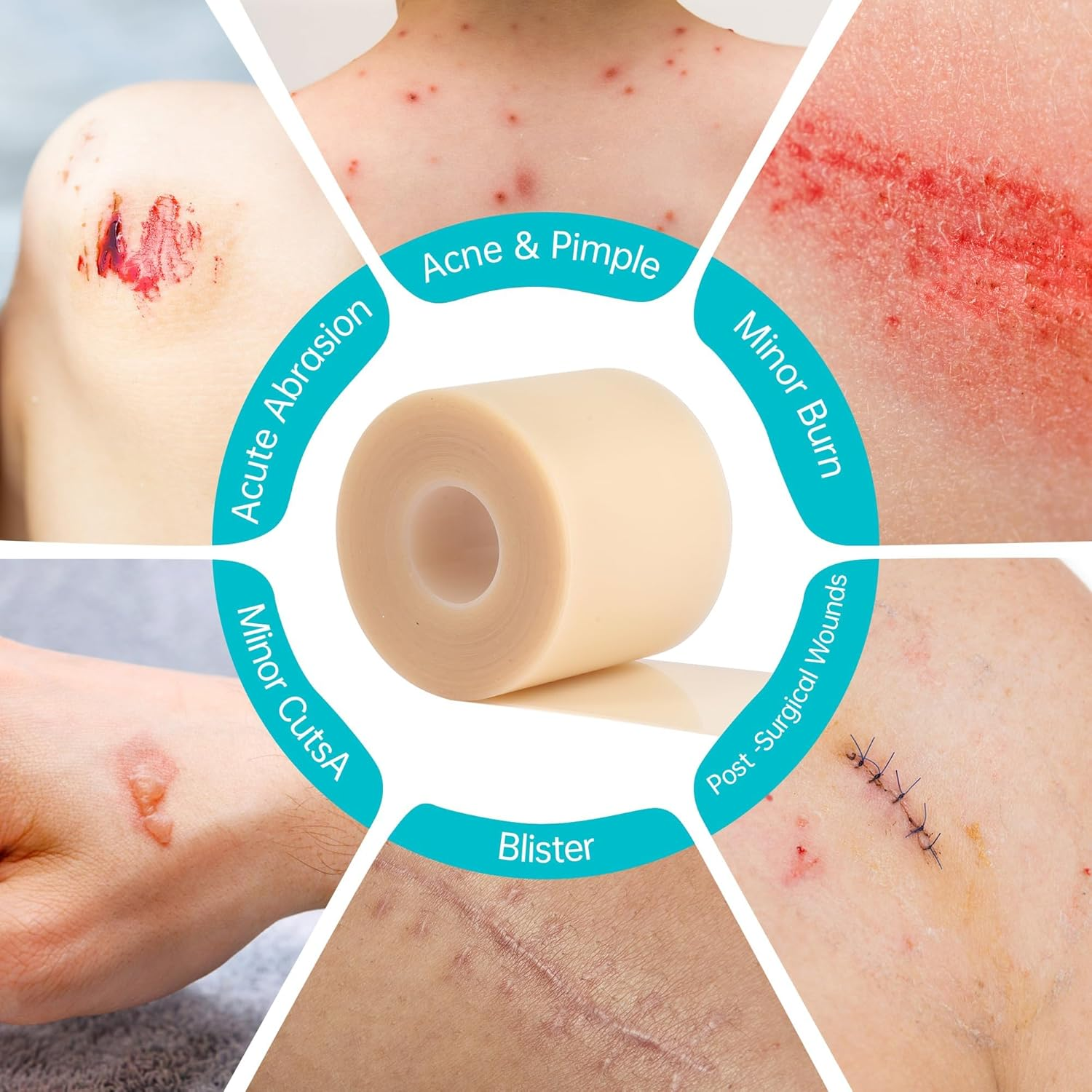 Hydrocolloid Roll for Wound Care, 5Cm*2M Hydrocolloid Bandages Rolls Tape, Waterproof and Ultra Absorbent Patch Bandages Cut-To-Size, First Aid Kit Essential for Burn Blister image number 4