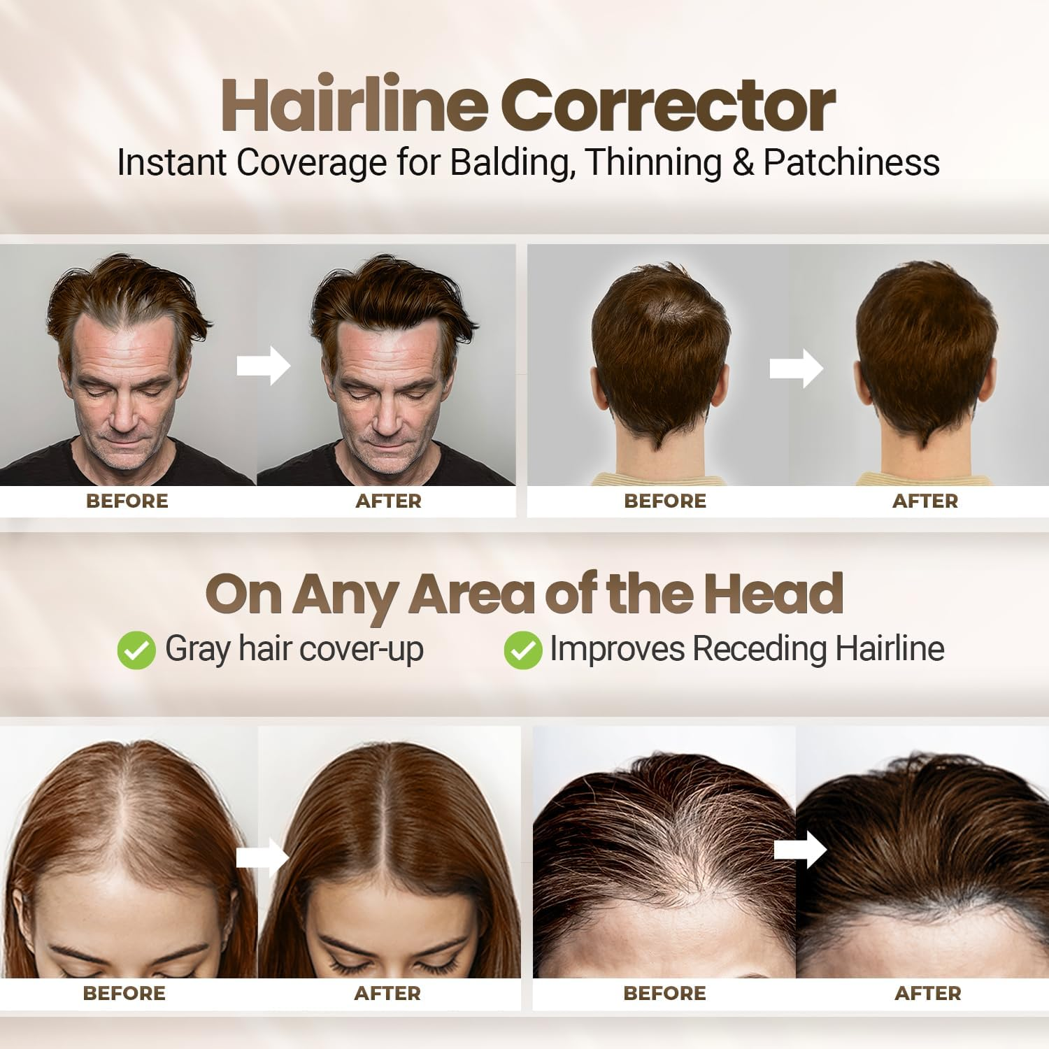 Koloret Root Touch up Powder&ndash; Medium Brown Powder for Women & Men, Instant Root Cover up for Gray Coverage, Hairline Concealer for Thinning Hair & Bald Spots, Water-Resistant & Smudge-Proof, 10G