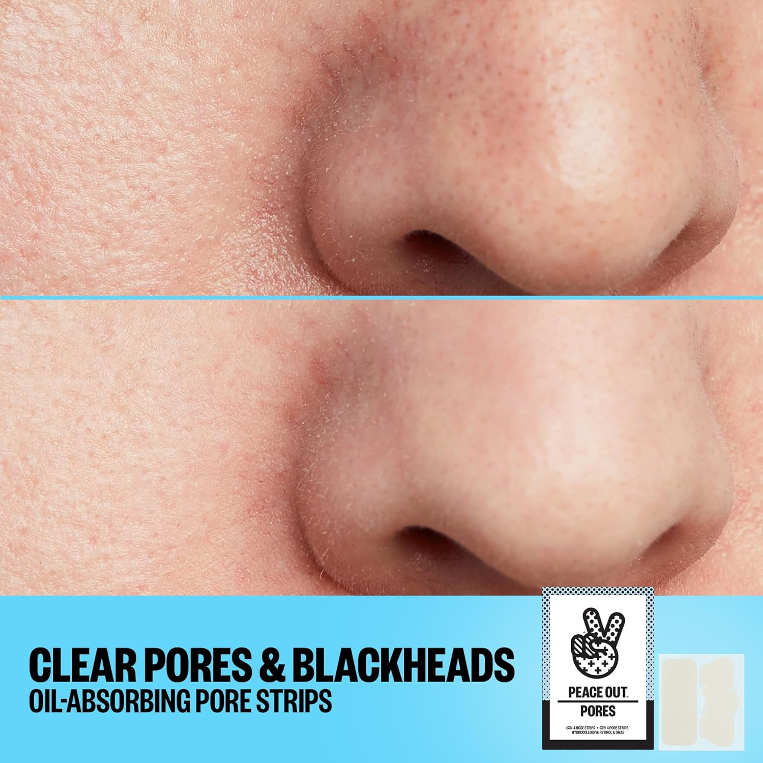 PEACE OUT Skincare Pores. Hydrocolloid Pore-Refining Nose and Face Strips with Vitamin a to Shrink Enlarged Pores and Remove Excess Oil (4 Pore and 4 Nose Strips) image number 2