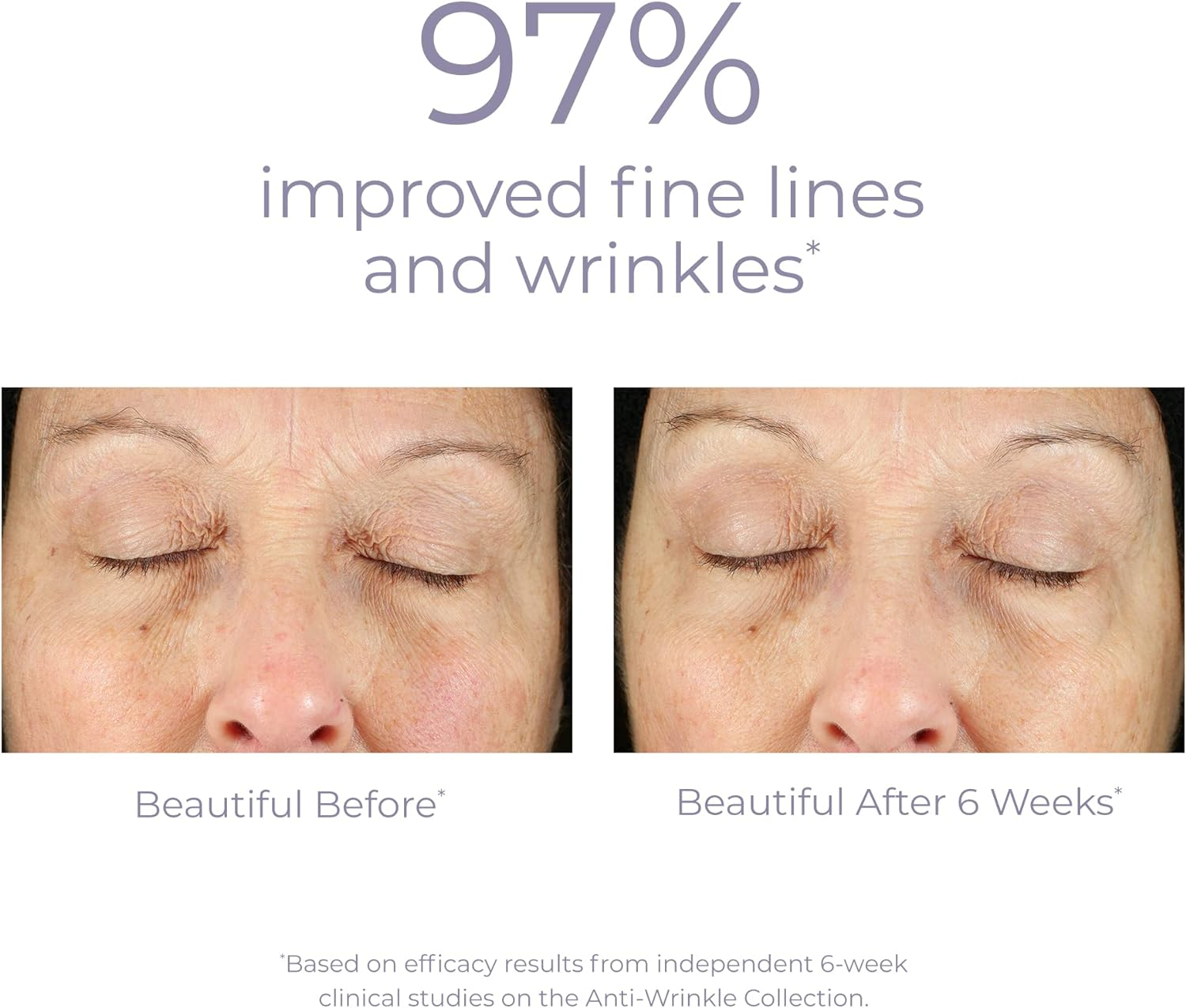 Derma E Anti-Wrinkle Renewal Cream with Vitamin a Retinyl Palmitate image number 6