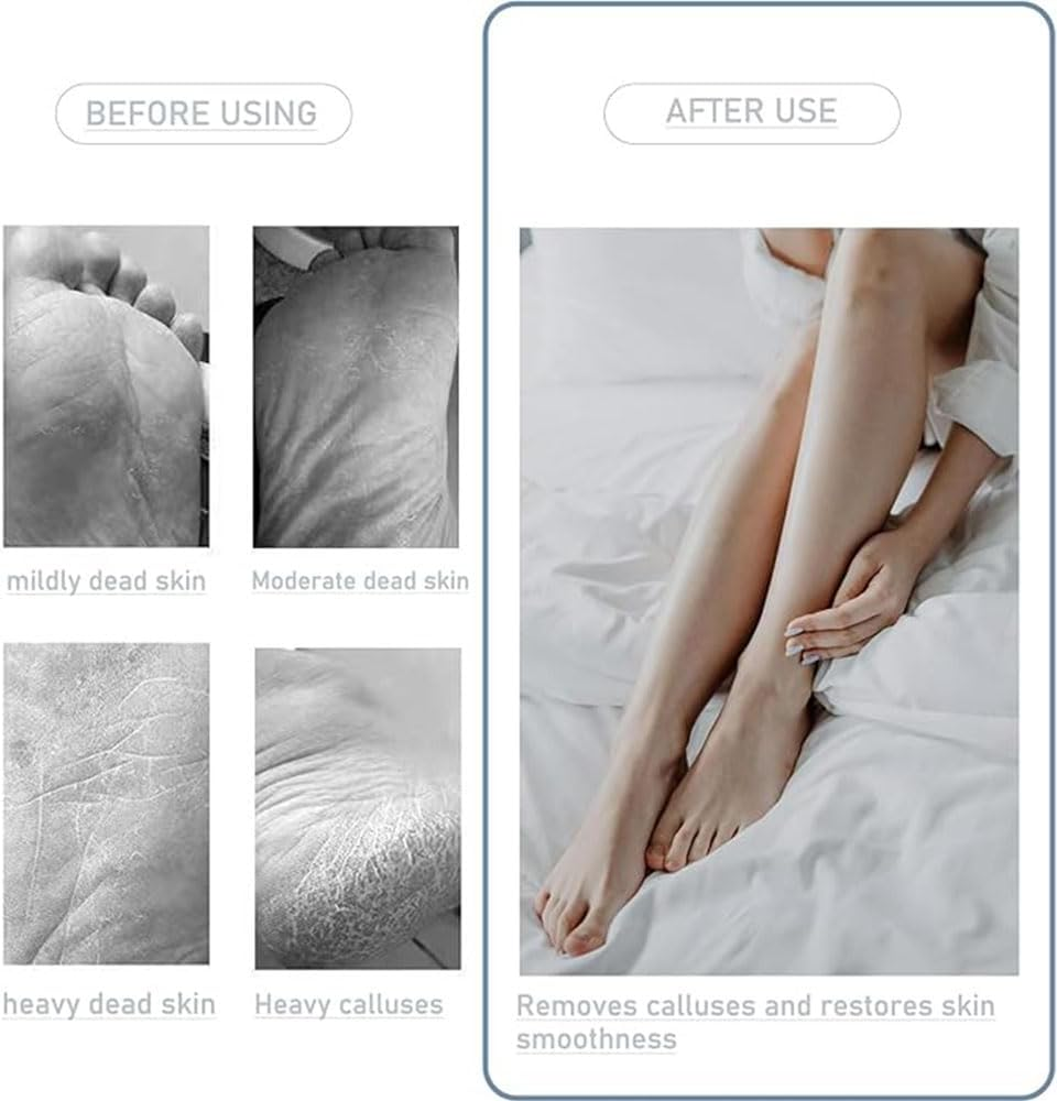 2PC Toe Gaps Cleaning Brush,Foot Brush for Shower with Long Handle,No Bending to Remove the Dead Skin of the Feet, Suitable for the Elderly, Pregnant Women (Pink) - Pink image number 1