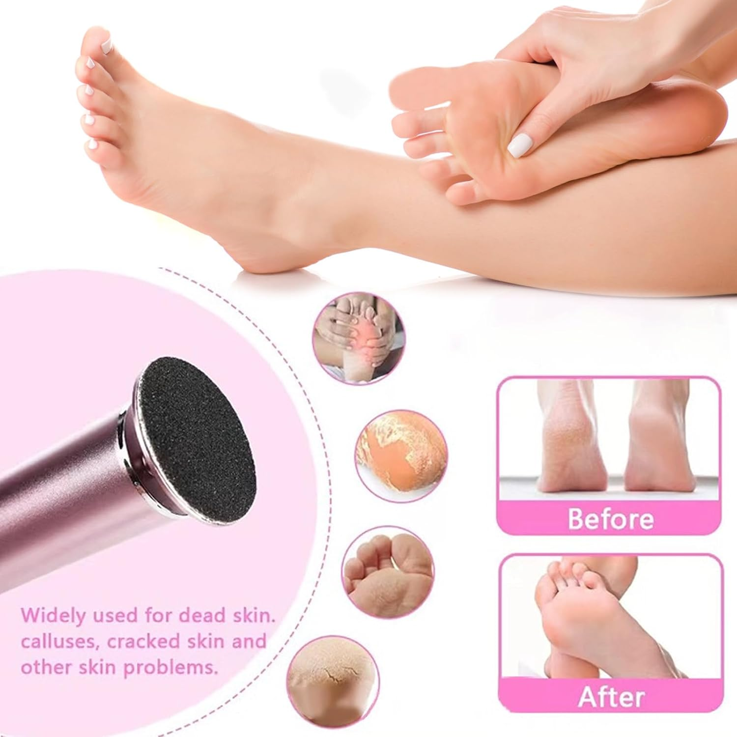 60 PCS Replaceable Sandpaper Discs, 80 & 120 Grit Pad Refills for Electric Foot File Callus Remover Machine Foot Hard Dead Skin Removal image number 3