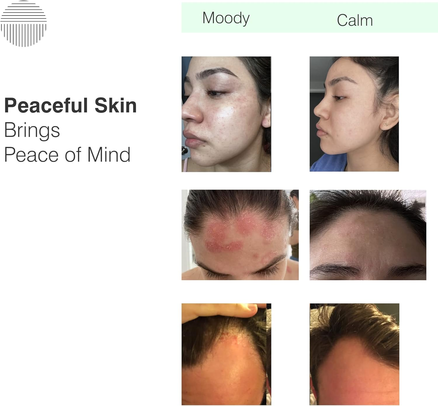 Dermazen Calming Seborrheic Serum, Dermatologist Recommended, Topical Serum for Hair, Face, and Body (4Oz)