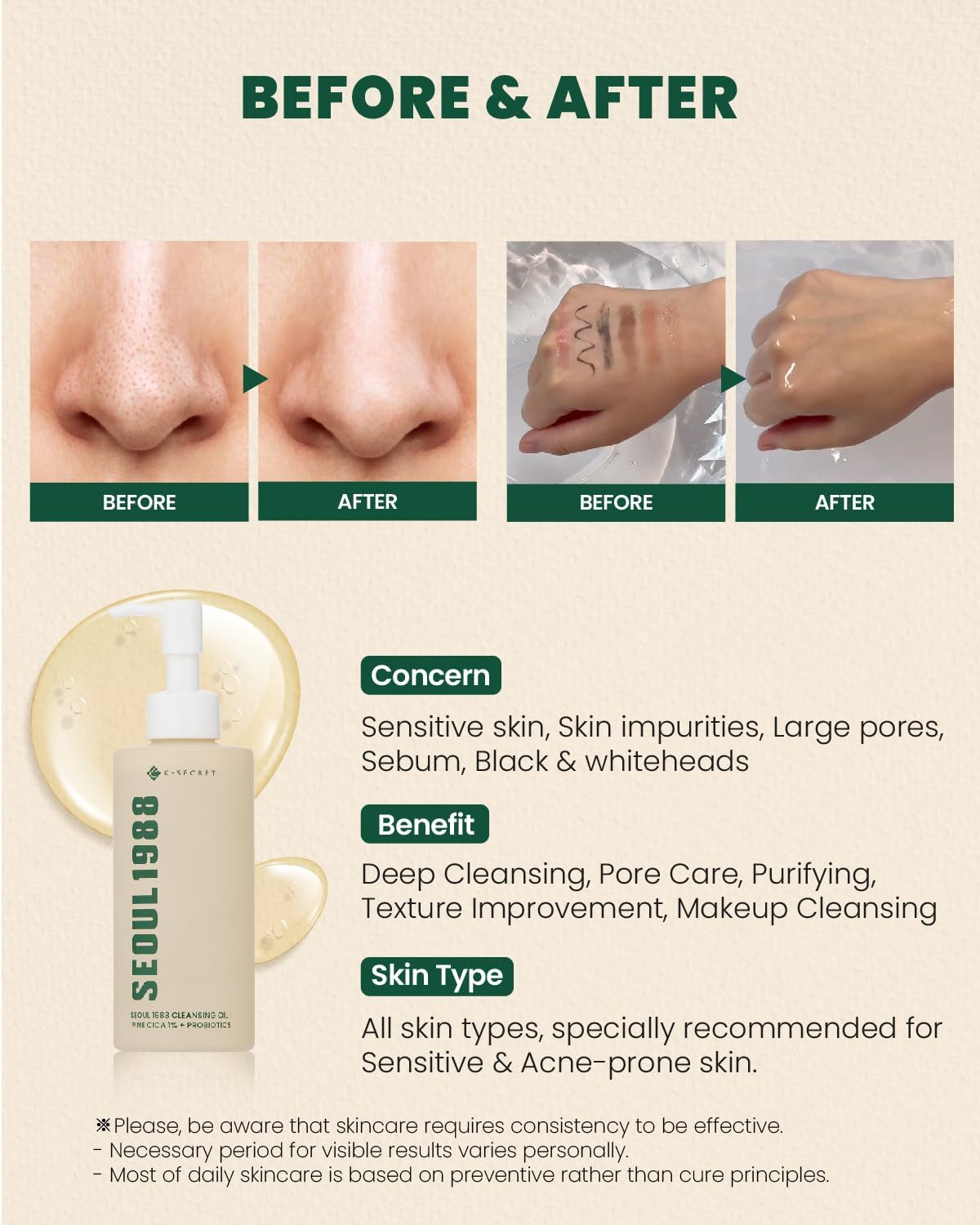 KSECRET SEOUL 1988 Cleansing Oil : Pine Cica 1% + Probiotics, 200Ml/6.76Fl.Oz. image number 3