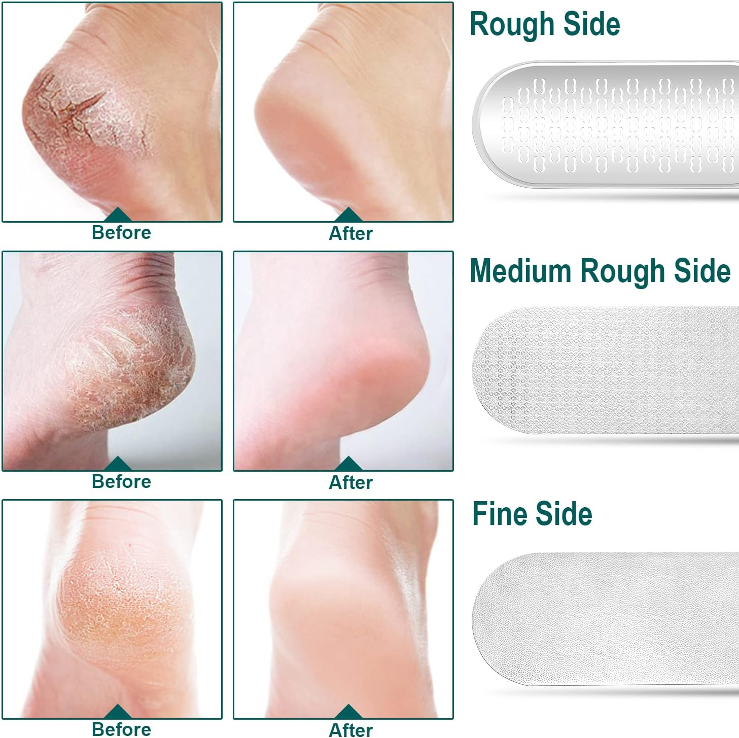 3-In-1 Multifunctional Foot File Cuticle Remover for Pedicure Foot Care (Grey-F6D) image number 1