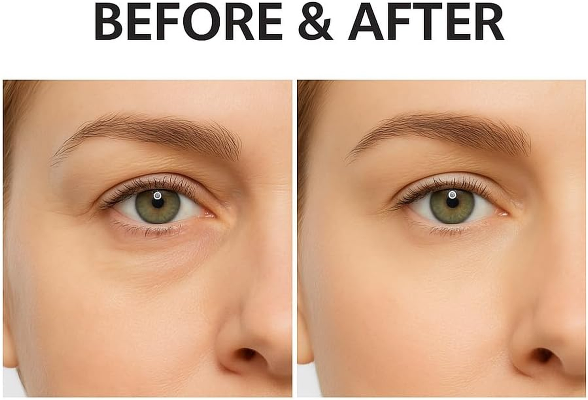 Eye Bag Eraser Firming Cream, Instant under Eye Tightener for Dark Circles, Puffiness & Wrinkles, Hydrating, Lifting, Anti-Aging Formula for Men, Women & All Skin Types (3) image number 6