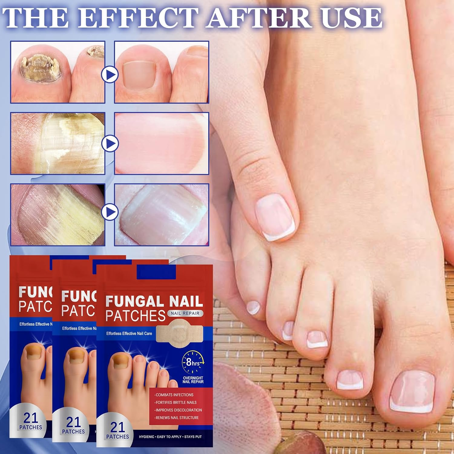 3 Packs of Toenail Treatment, Nail Digging Repair Patches, Split Nail Repair Strengthening Nails, Nail Digging Repair Plasters for Damaged Nails and the Appearance of Discoloured Nails