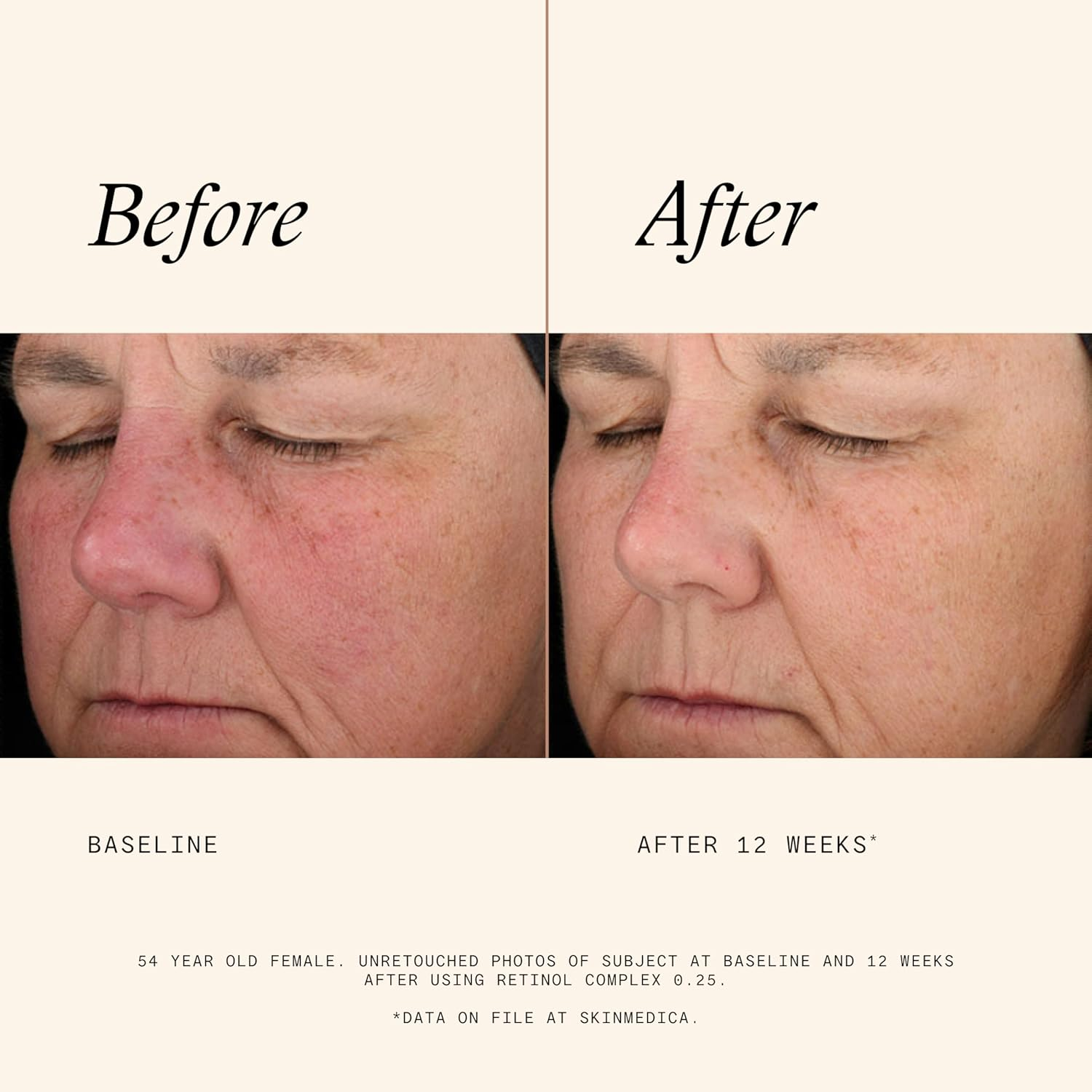 Skinmedica Retinol 0.25 Complex - Retinol Serum for Face, Age-Defying Advanced Retinol Cream That Renews Skin and Diminishes the Appearance of Fine Lines and Wrinkles, 1 Fl Oz image number 6