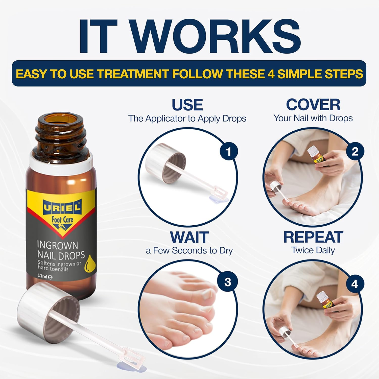 URIEL UPGRADED Ingrown Toenail Treatment, Ingrown Toenail Removal Kit, Ingrown Toenail Corrector, Ingrown Nail Kit Ingrown Toenail Tool 20Ml