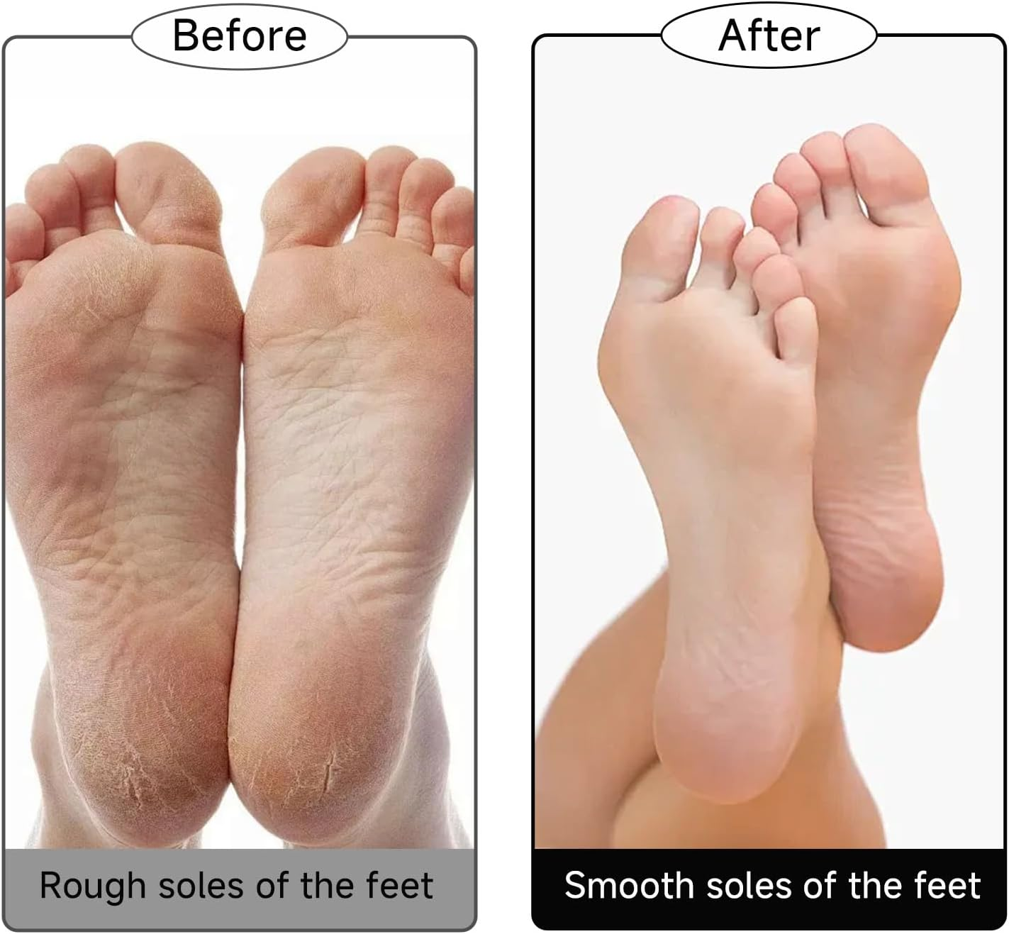 Shingidea 4 Pcs Natural Lava Pumice Stone for Feet Callus Remover, 9X6X2.6Cm Grey Exfoliating Foot File and Pedicure Tools, Hard Skin Dead Removal Professional Care Home Spa Treatment image number 2