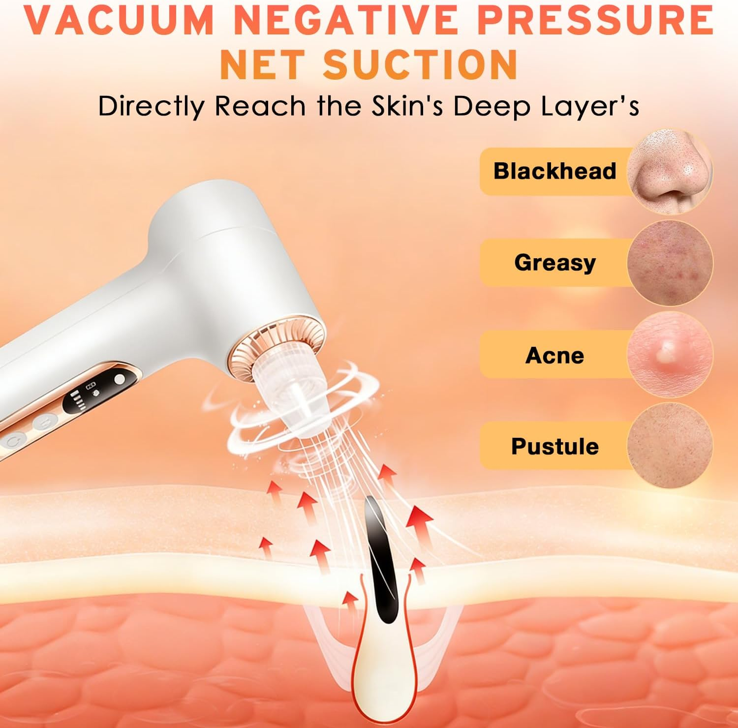 Yakiter Blackhead Remover, Pore Extractor Black Head Vacuum Remover with Heating, 5 Adjustable Suction Levels, 6 Replaceable Heads, Comedone Extractor Kit for Face Deep Cleansing (Gold) image number 6