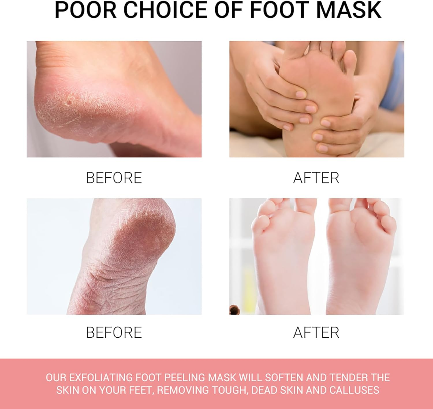 Fantasyday Foot Peel Mask,3 Pack Foot Peeling Mask for Soft Baby Feet - Hard Skin Remover Foot Mask, Removes Calluses and Hard Skin, Foot Care for Men and Women (Peach) image number 5