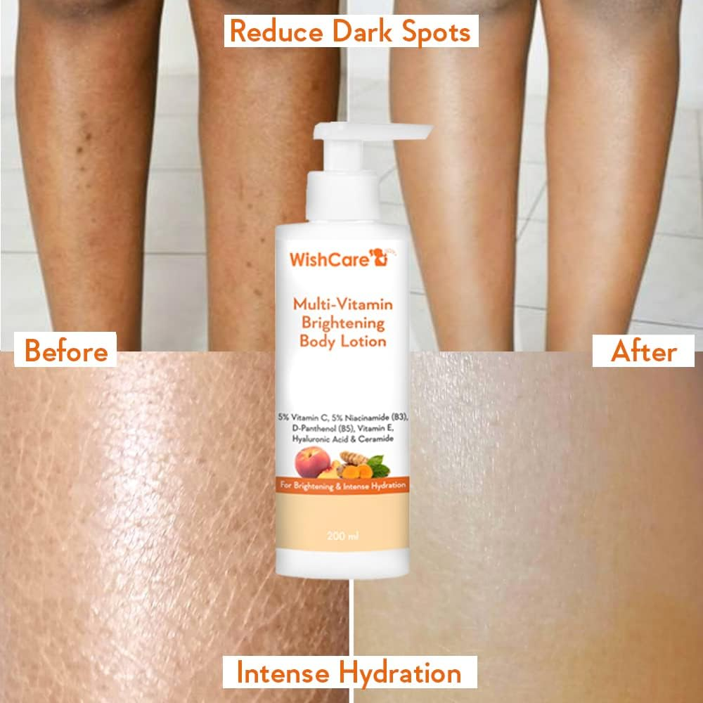 Wishcare Multi-Vitamin Brightening Body Lotion - 5% Vitamin C, 5% Niacinamide(B3), Panthenol(B5), Vitamin E, Turmeric & Kakadu Plum - for Men & Women - 200 Ml image number 3