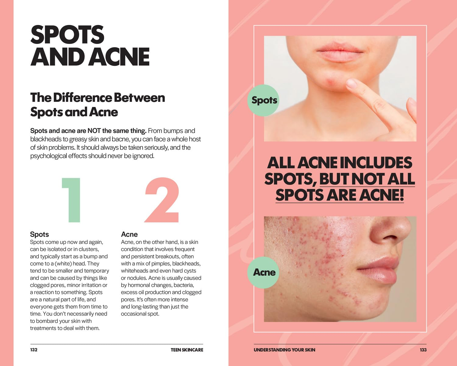 Teen Skincare: the Ultimate No Nonsense Guide image number 3