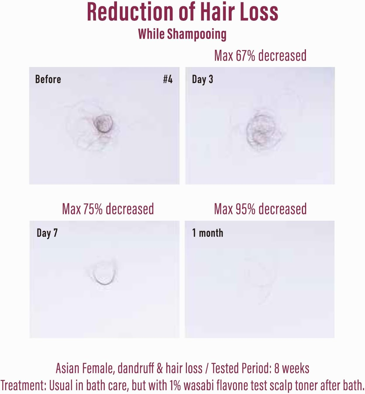 Naturelab Moist Diane Perfect Beauty Extra Hair Fall Control Shampoo 450 Ml