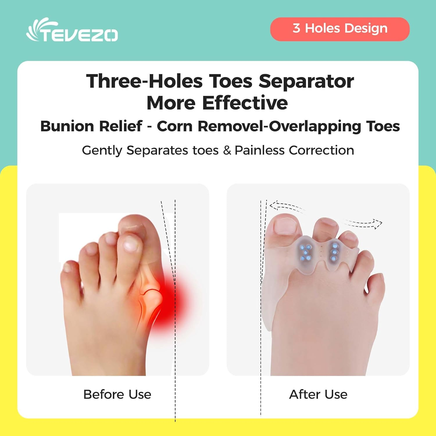 Kids Toe Separator and Protectors
