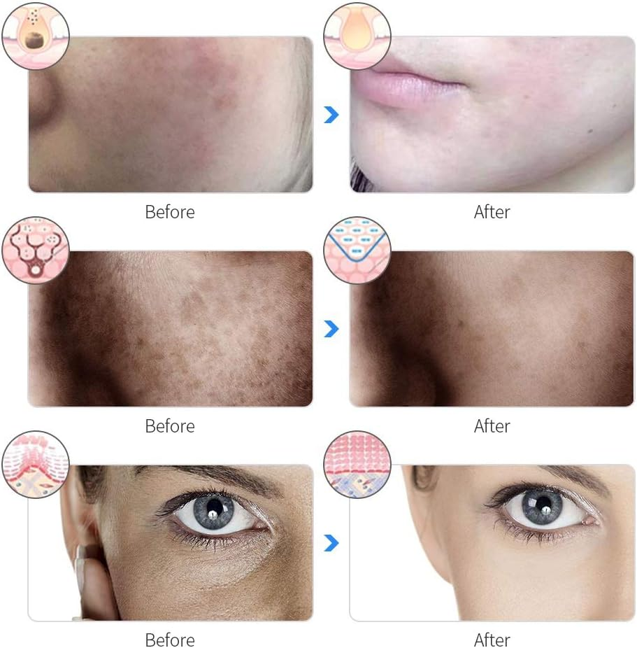 Light Face Mask 7 Colors Photon LED Light Therapy Beauty Mask, Skin Rejuvenation Face Lifting Whitening Beauty Mask for Home Use