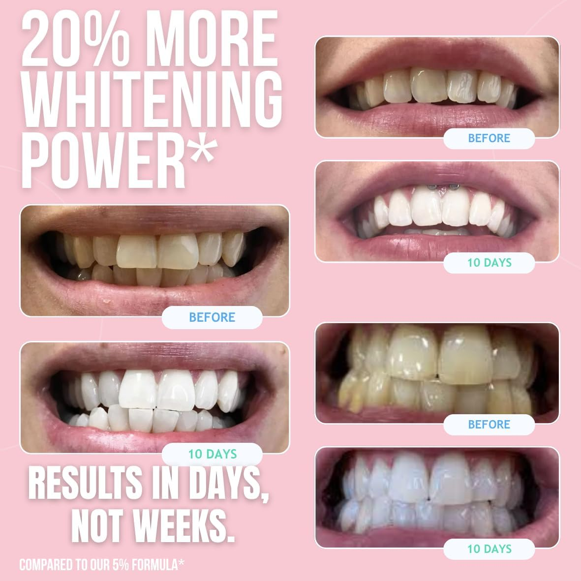 GLOW STRIPS&trade; 14 Express Teeth Whitening Strips + 2Ml Glow Pen + Restore+ Nano-Hydroxyapatite Toothpaste &ndash; Enamel-Safe, Fast Teeth Whitening Kit with Post-Whitening Care image number 3