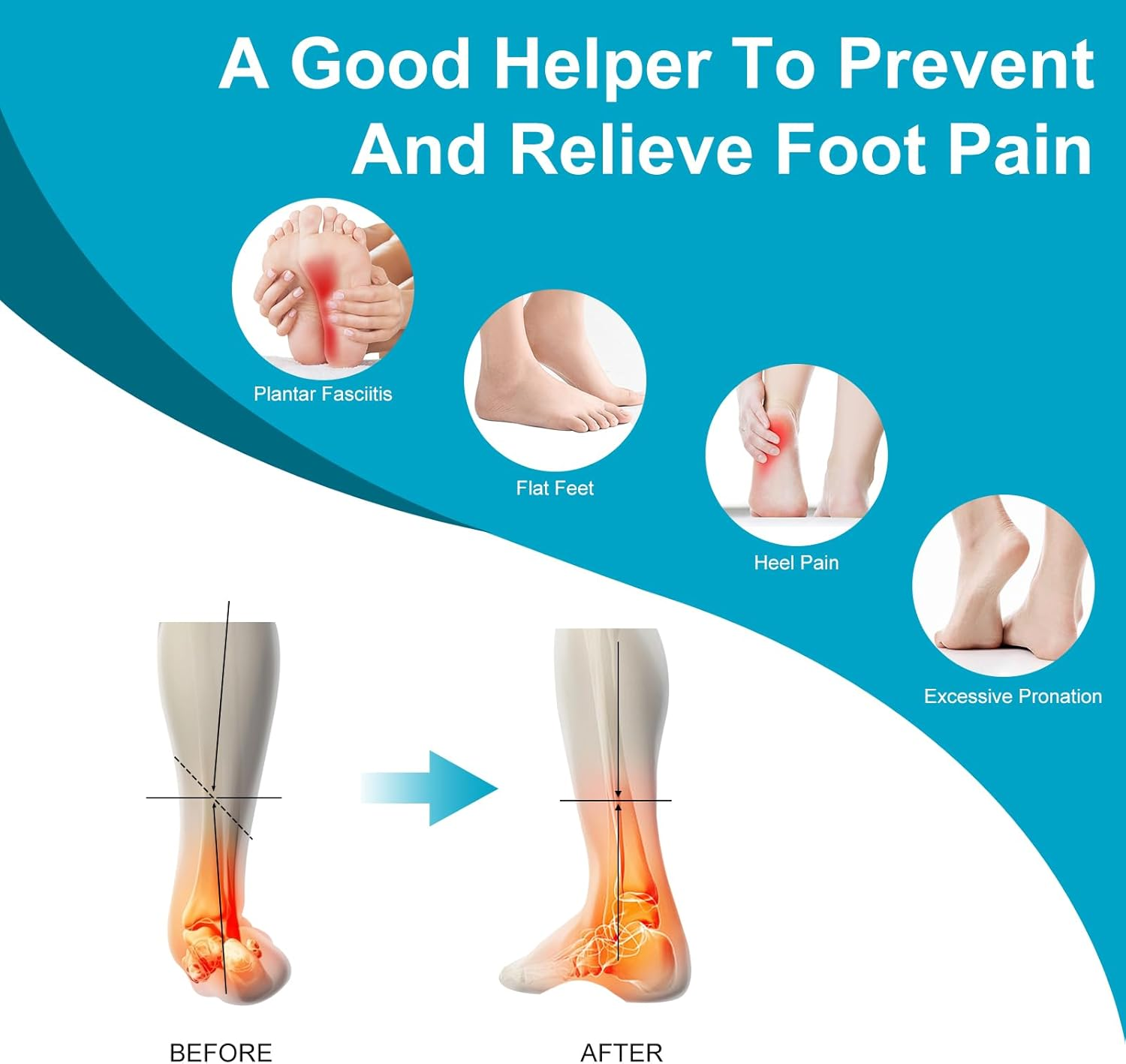 Arch Support Insoles for Men and Women, Insoles for Flat Feet, Orthotic Insole for Flat Feet and Arch Pain(Xs(Eu 37-39),Blue) image number 3