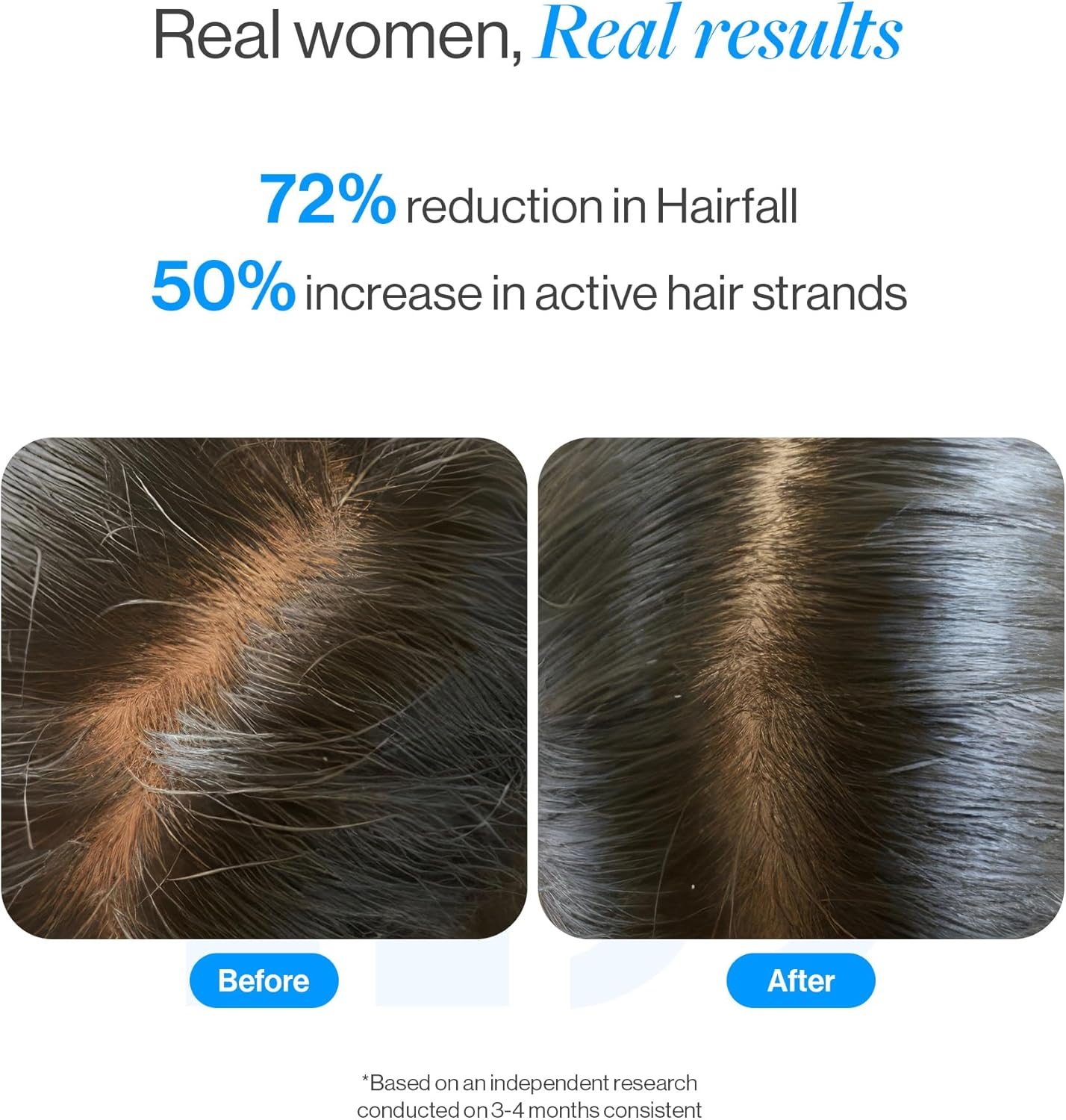 Be Bodywise Rosemary Hair Growth Serum (Roll On)|Promotes Hair Growth & Stimulates Hair Follicles |3% Rosemary, 3% Redensyl & 2% Anagain | Hair Fall Control Serum for Unisex |For All Hair Types | 50Ml image number 3