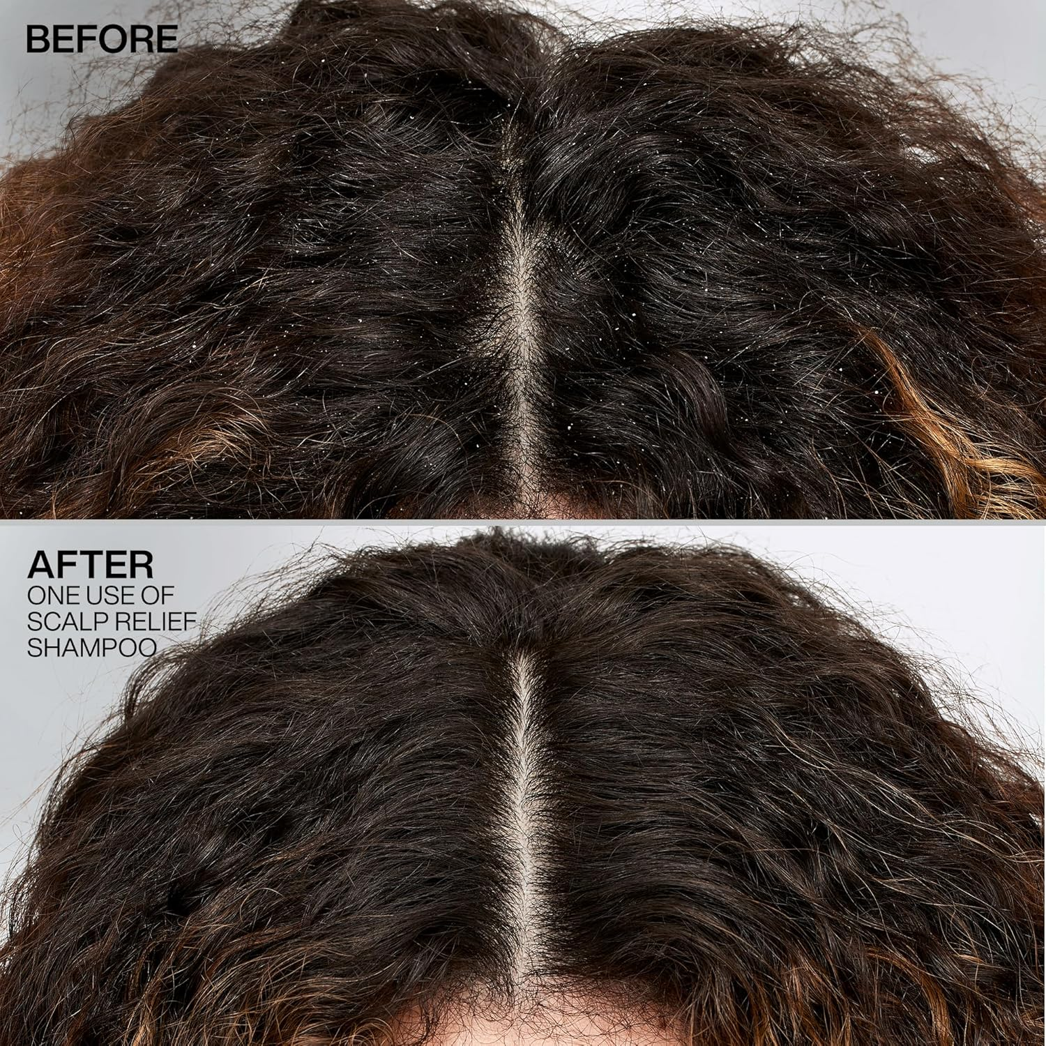 Redken Scalp Relief Dandruff Control Shampoo 300 Ml image number 1