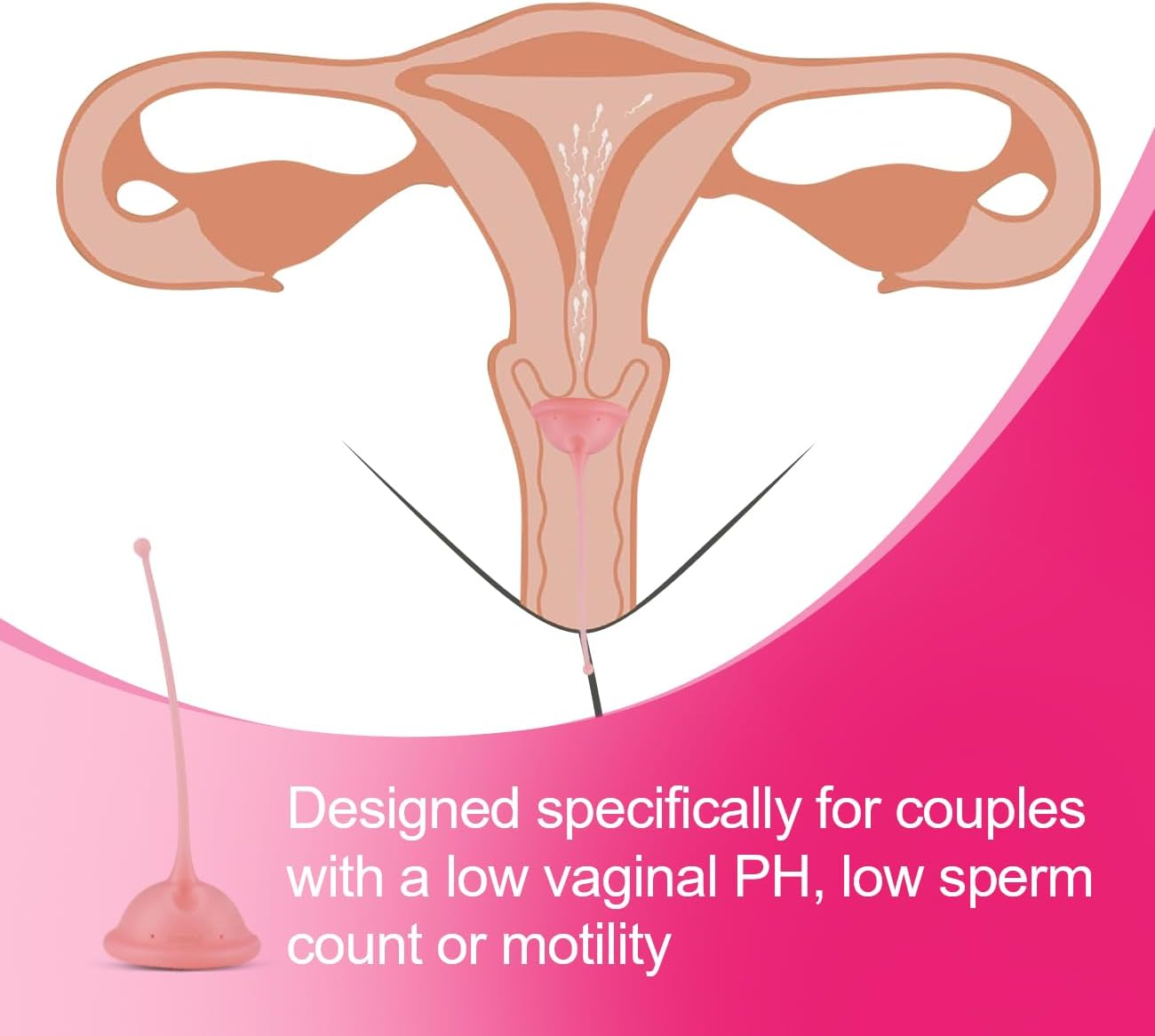 Cervix Sperm Cup,Pink image number 1