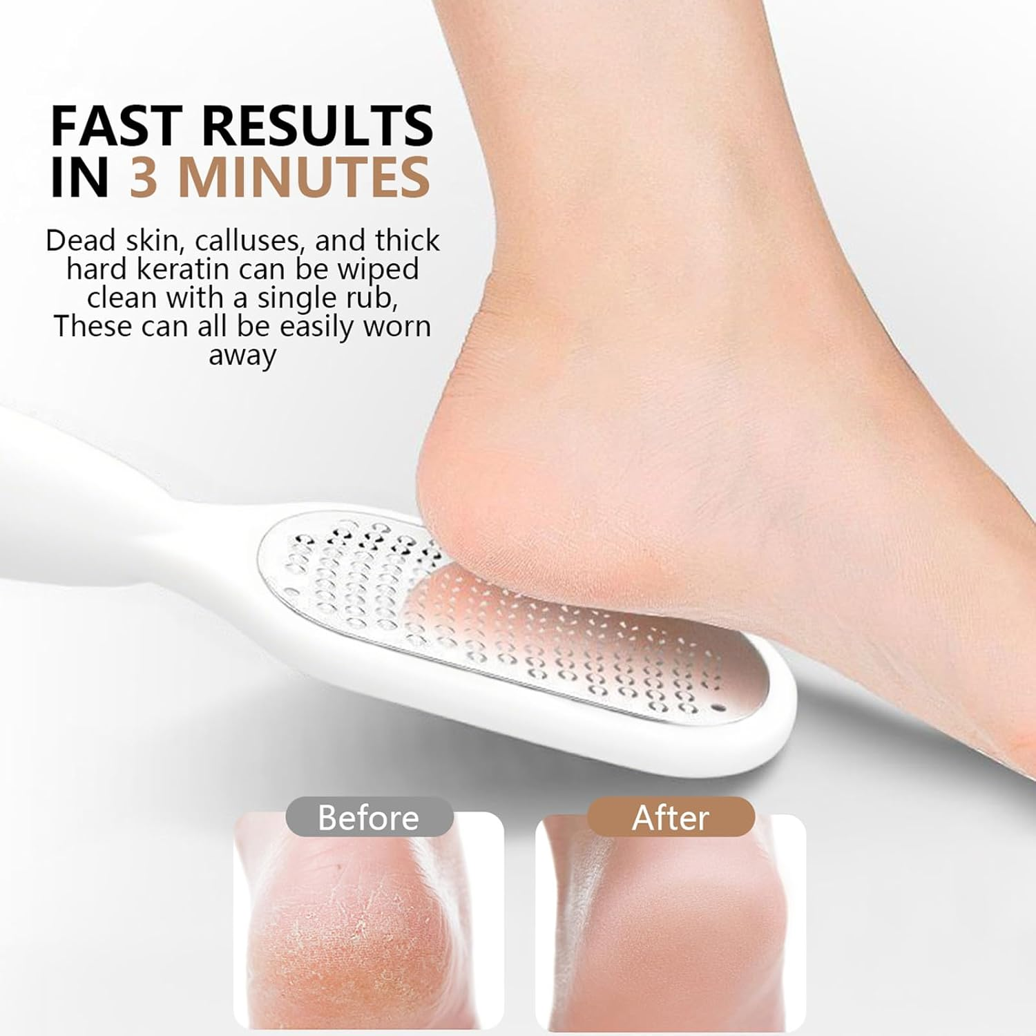 Pack of 2 Pedicure Callus Rasp 2-In-1 with Crumb Tray - for Dry and Wet Feet - Removes Calluses - Double Foot Rasp (Black and White)