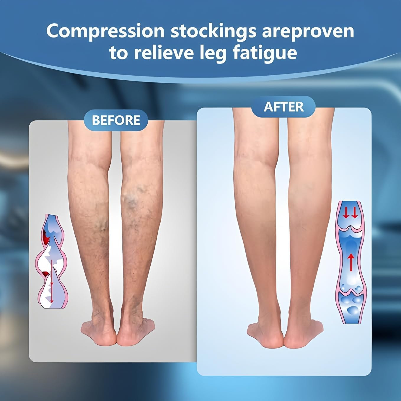 2 Pairs Open Toe Compression Socks for Men & Women 15-20 Mmhg Knee High Flight & Travel Socks for Circulation Support image number 4