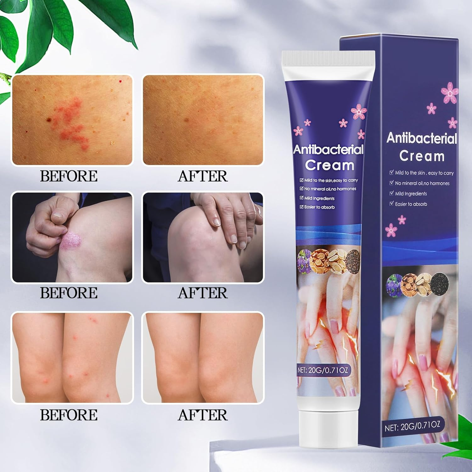 Psoriasis Creams Dermatitis Cream,Eczema,Soothes Red & Inflamed Skin,Moisturizing Body Cream,Lotion image number 3