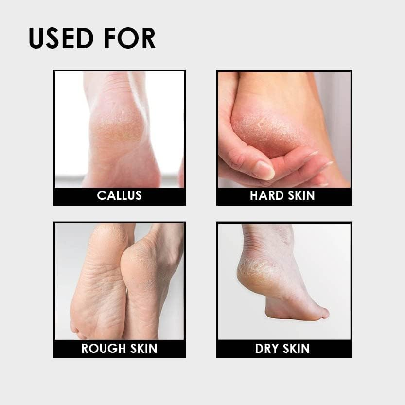 PRO ESSENTIALS BRUSH & PUMICE COMBO I PUMICE STONE I CALLUS REMOVER image number 1