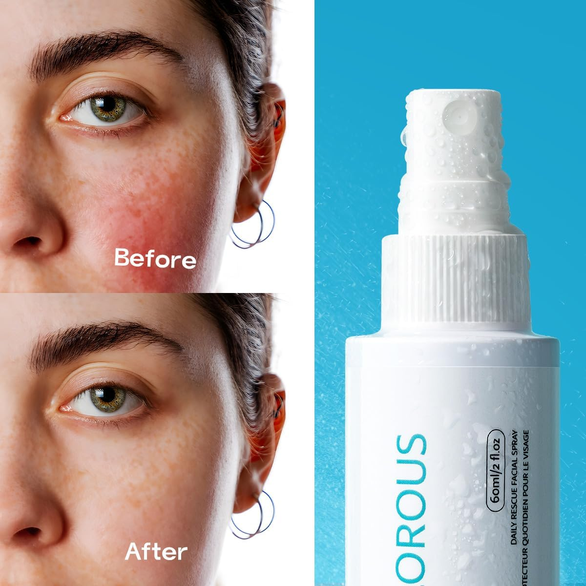 Hypochlorous Acid Face and Skin Spray,Safe for Use on Acne Prone Skin, Dry Scalp, Toner, Eye Lash Cleanser, Face and Hand Cleanser - 60Ml image number 4