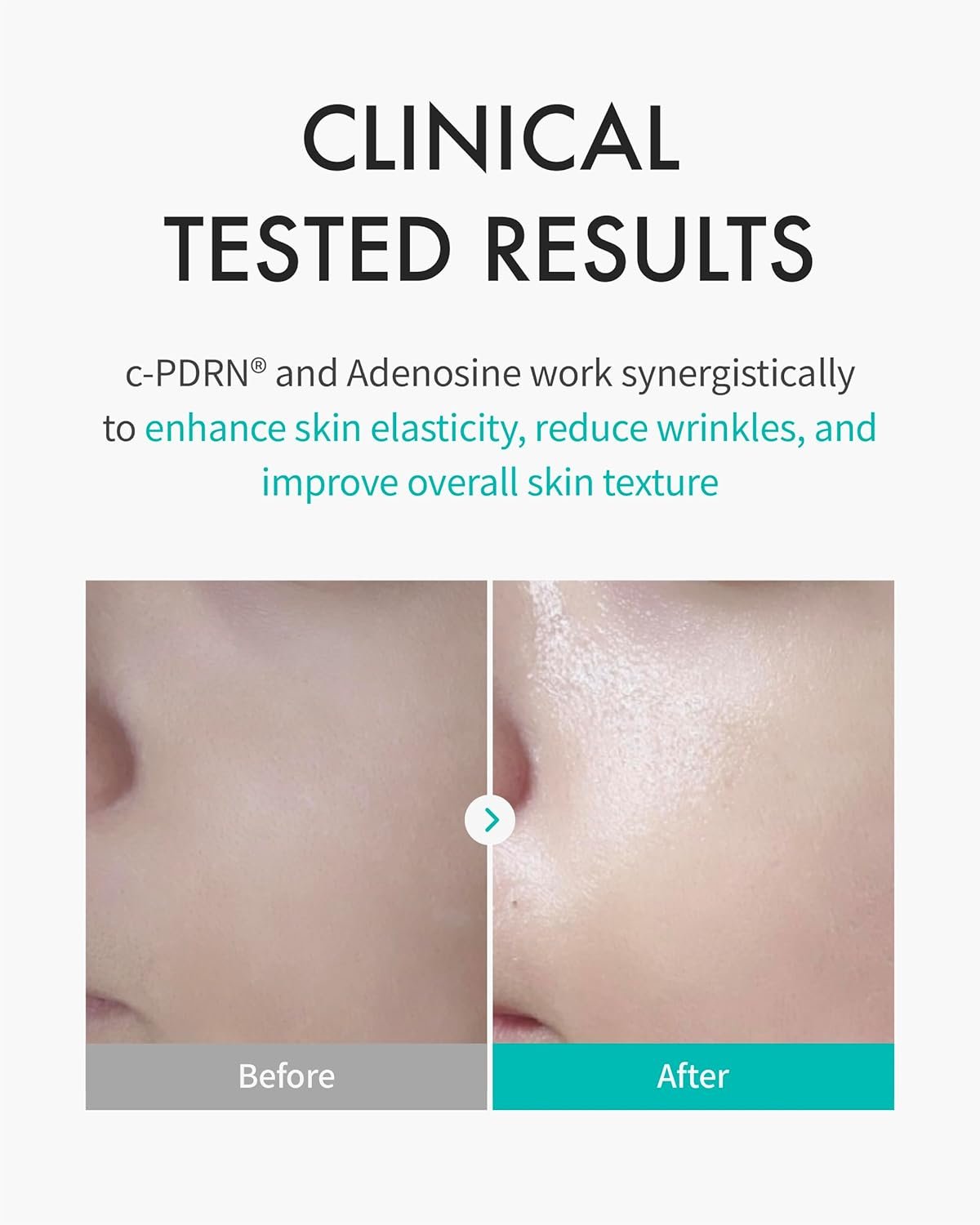 Rejuran Healer REJURAN TURNOVER MASK